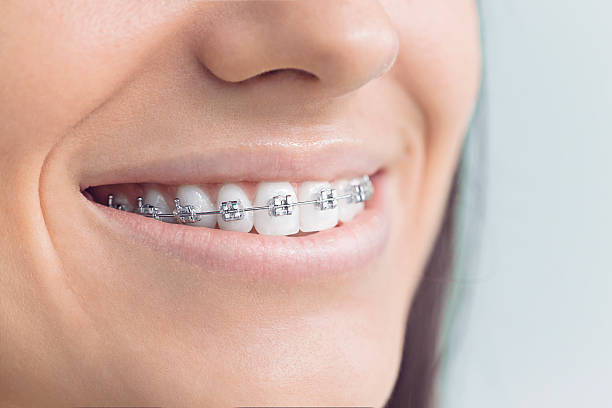 Best Dental Fillings (Composite and Amalgam)  in Olathe, KS